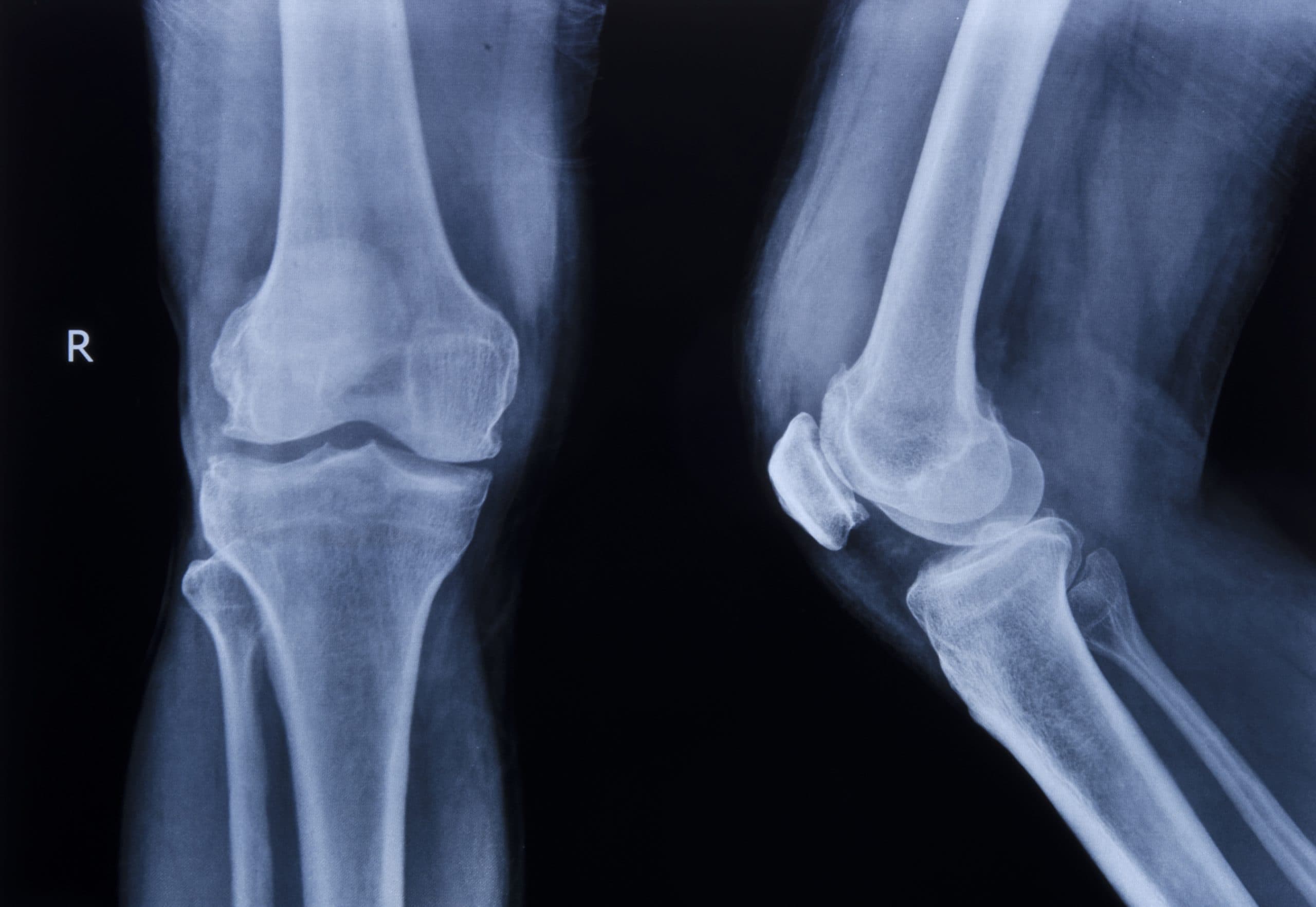 Pre-operative knee imaging review