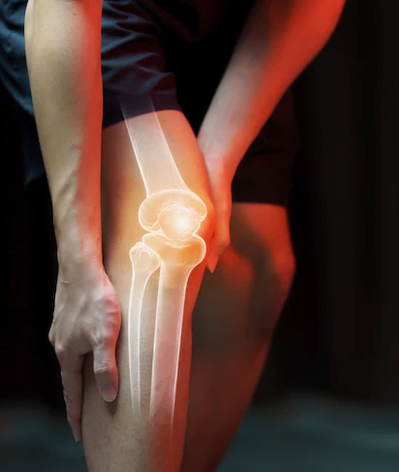 Hip and knee replacement decision-making